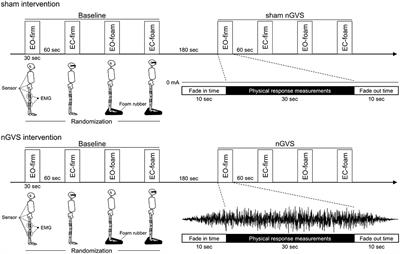 Effects of Noisy Galvanic Vestibular Stimulation on the Muscle Activity and Joint Movements in Different Standing Postures Conditions